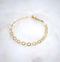 Orb Bracelet